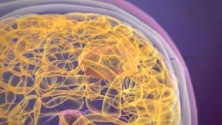 NanoTherm® Therapy
