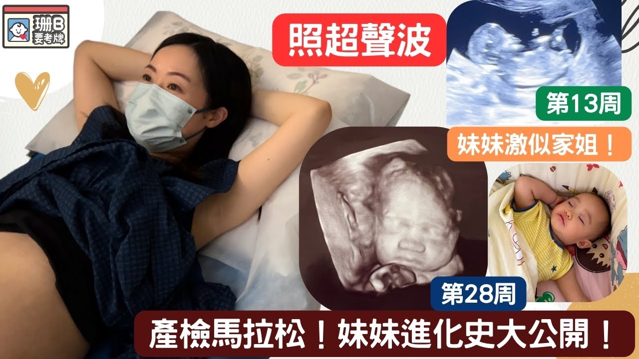 【珊B要考牌 #68】 產檢馬拉松🤰！妹妹進化史大公開👶🏻！同家姐激似樣🤯！｜照超聲波｜T21 ｜Oscar