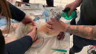 Paramedic Neonatal Resuscitation case 5