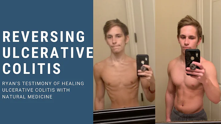 Young Man Heals Ulcerative Colitis, Ulcerative Col...