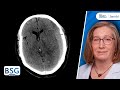 Traumatic brain injury management  neurosurgery course  march 2 2023