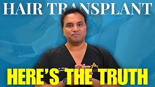 Hair Transplant: What to Expect After Surgery