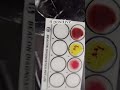BLOOD GROUP PRACTICAL🩸💉 #bloodgroup #peramedical #practical #nursing #medical #shorts #viralvideo