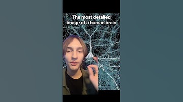 The Most Detailed Image Of A Human Brain