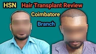 HSN coiambatore branch Hair Transplant review / Raju HT / Hair Transplant tamil / #hsn