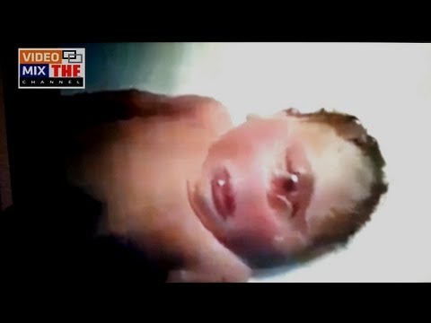 Real Cyclops Baby - YouTube