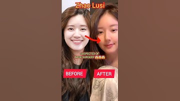 Could this be real???😲😱.. Cute face turns Stiff😢😰 #zhaolusi #celebrity #foryou #pleasesubscribe