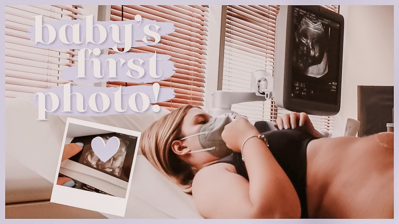 Ekoja morfologjike. Fotoja e pare e bebit! 😍 | Sara Karaj