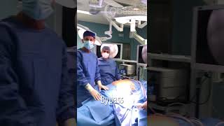 Intervención De Bypass Sadis. Clínica Obesitas.