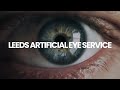Introducing the leeds artificial eye service
