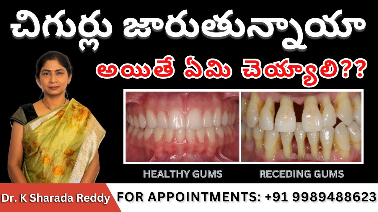 I Tried Treating My Receding Gums and You Won't Believe the Results!