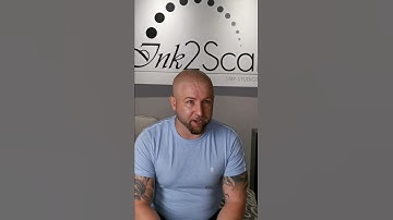 Must See! Scalp Micropigmentation Testimonial - Ink 2 Scalp SMP Studios | Ontario