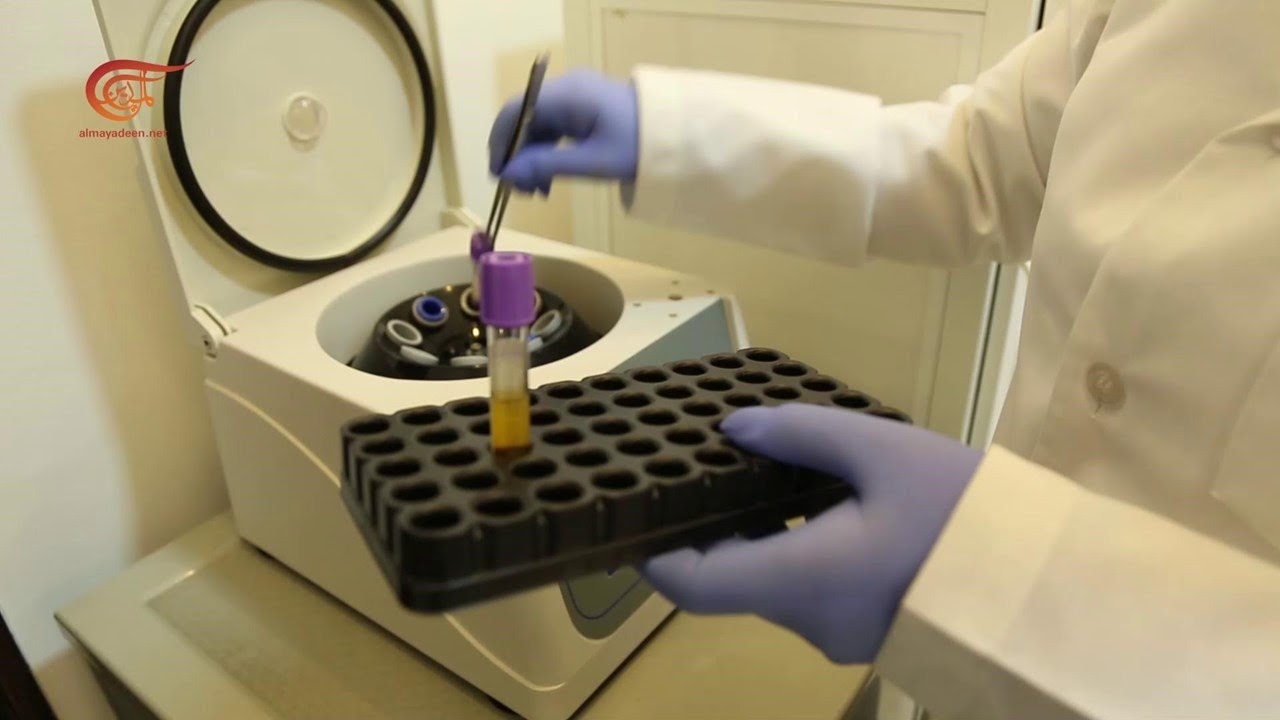 العلاج ببلازما الفيبرين (Platelet rich fibrin)