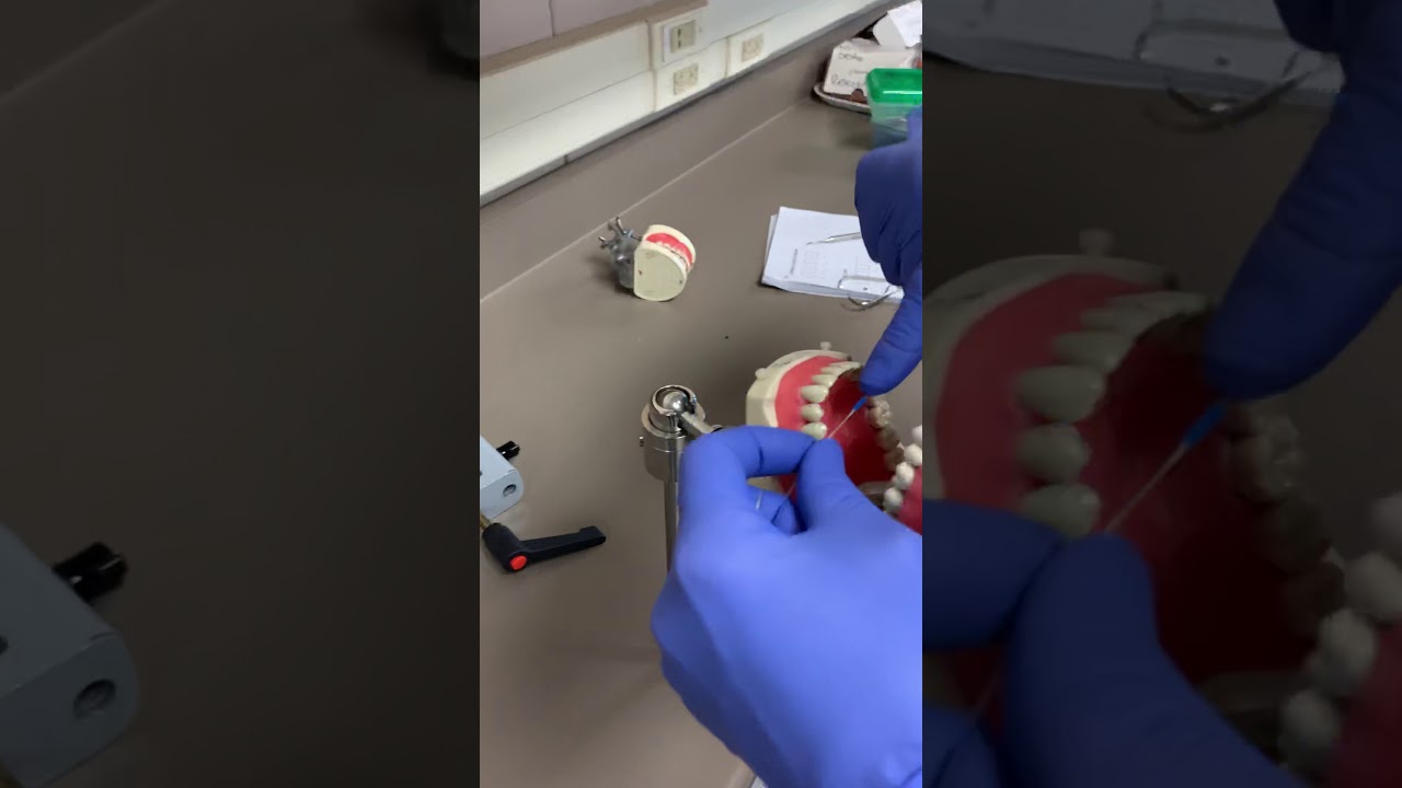 Placement of elastic separators with dental floss