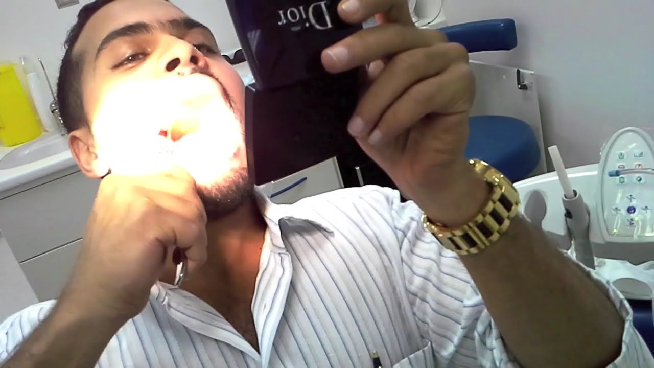 Self Extraction 3rd molar (wisdom tooth) Dr Raid Khayat - YouTube