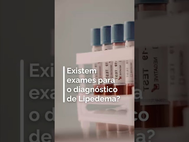 Diagnóstico de lipedema é clínico, entenda porque isto acontece.