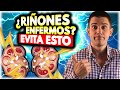 👉🚫Estos 5+1 Alimentos pueden perjudicar tus RIÑONES *si tienes Insuficiencia Renal* ⚡ [Evítalos]