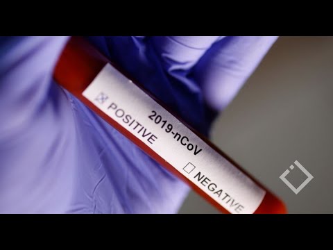 საქართველოში კორონავირუსით ინფიცირების 30 ახალი შემთხვევა დაფიქსირდა