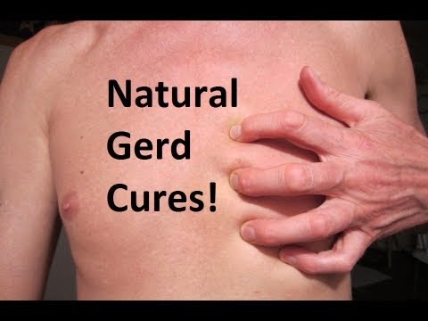 Natural GERD Cure &amp; Treatment! Remedy for GERD! *** - YouTube