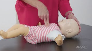 Expert Demo: How to Do Infant CPR | WebMD