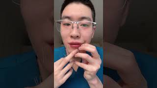 #Acupuncture conditioning#Mahuang Xiaoze#Daily life of Chinese medicine students It s been