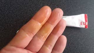 Betadine skin cream description