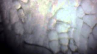 kemik zarı hücreleri:periosteum cells:περιόστεο κύτταρα :deneymetre.com