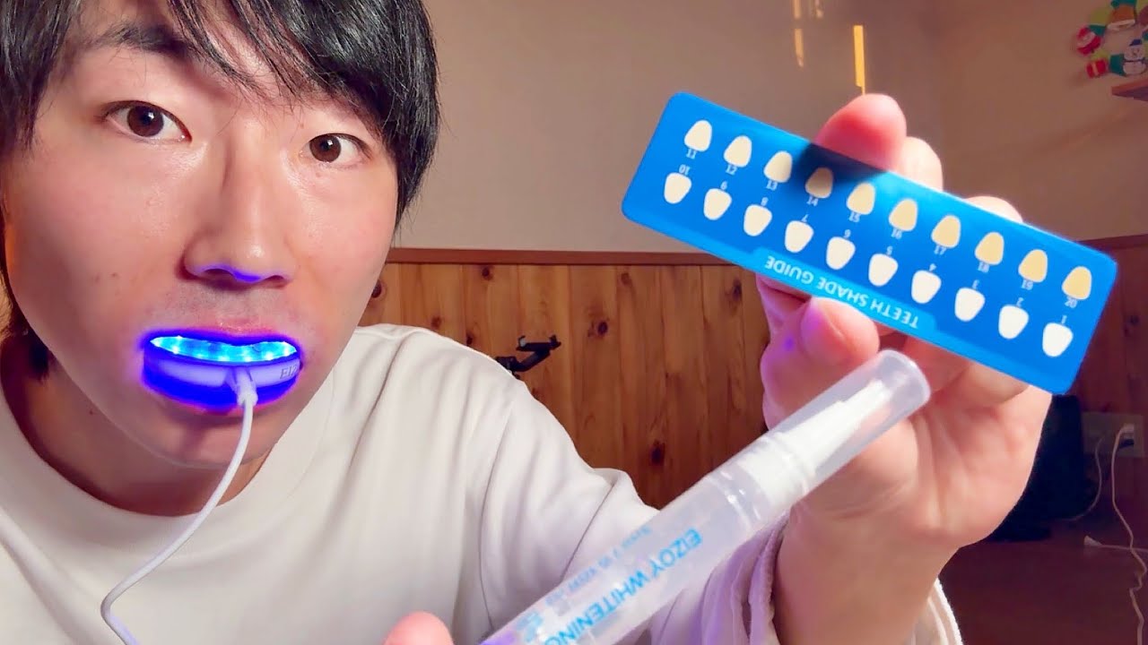 海外製の怪しいホワイトニングキットで歯を白くしてみた！