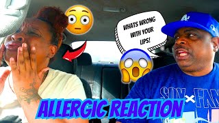 EPIC JUMBO LIPS OUT IN PUBLIC PRANK ON FIANCE! *HILARIOUS REACTION*