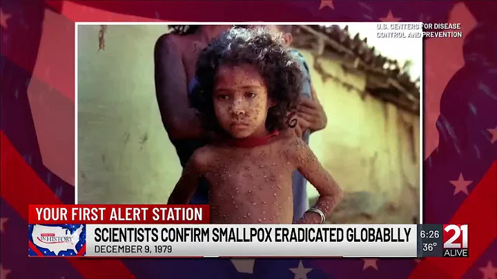 This Day in History: December 9, 1979: Scientists confirm smallpox has been eradicated globally