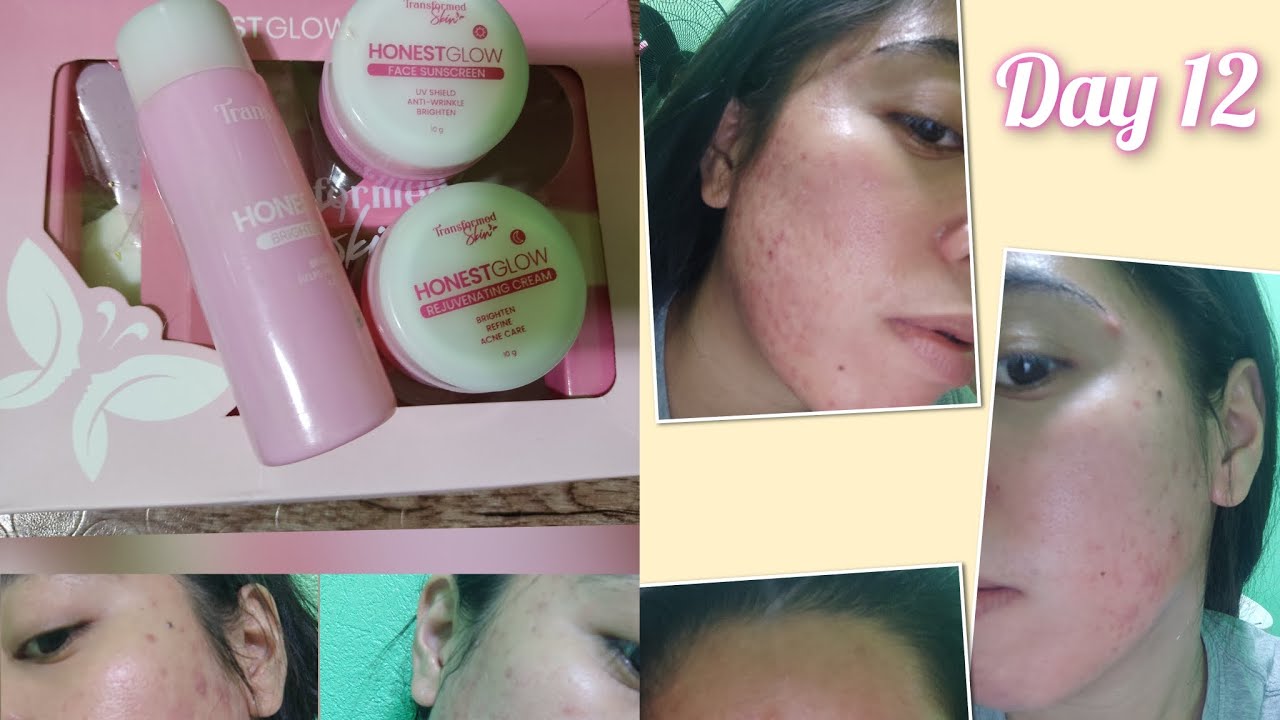 12 Days Honest Glow Rejuvenating Set Review Honest Yern YouTube 12-days-honest-glow-rejuvenating-set-review-honest-yern-youtube