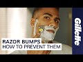 Want to Prevent Razor Bumps? Learn How to Minimize Ingrown Hairs | Gillette
