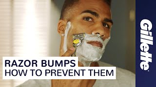 Want to Prevent Razor Bumps? Learn How to Minimize Ingrown Hairs | Gillette