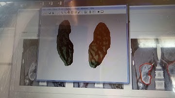 Segmentation driven image registration application to 4D DCE MRI recording of moving kidneys