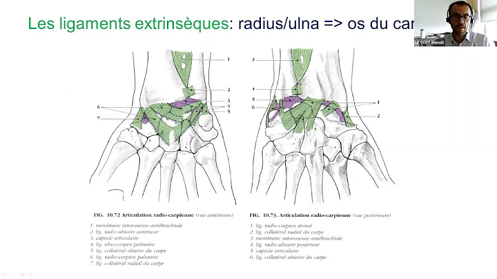 Benoit LE GOFF-Douleurs du poignet d origine ligam...