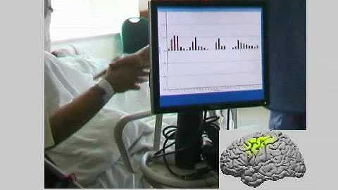 Realtime Electrocorticographic Brain Mapping