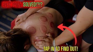 Entire Back Breakdown (What’s Actually Causing Your Back Pain) + Live Massage Fix