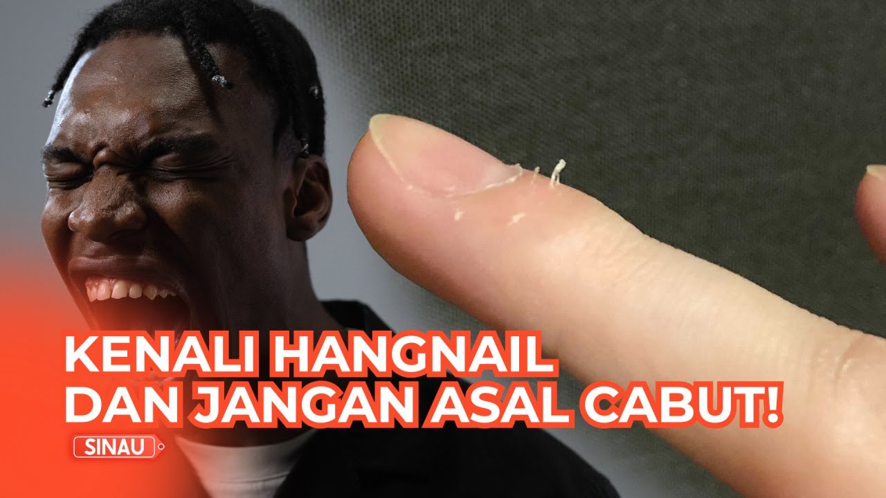 Mari Kenali Apa Itu Hangnail dan Akibatnya Jika Asal Dicabut