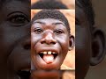 Meet Nsanzimana Elie Once Living In The Dense Forests Known By Locals As The Monkey Boy Meet Nsanzimana Elie Once Living In The Dense Forests Known By Locals As The Monkey Boy