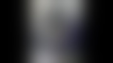 Sentinel Node Mapping in Endometrial Cancer using ICG dye & DaVinci Xi Firefly mode