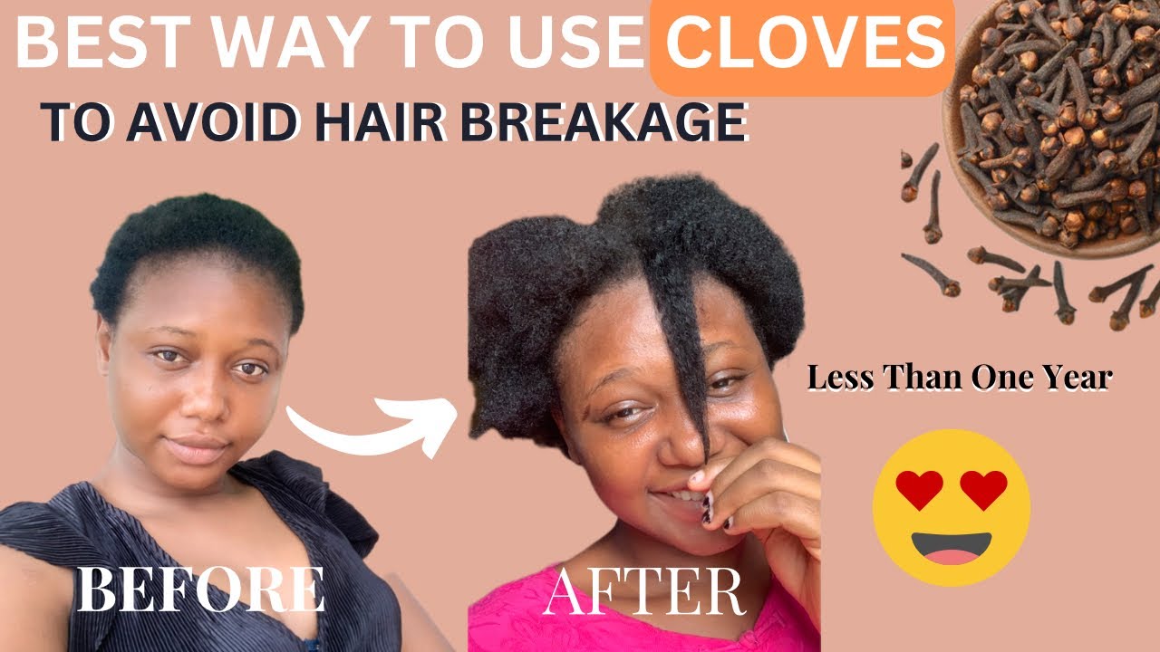 How to Use Cloves Effectively For Fast Hair Growth 4a 4b 4c Powerful
