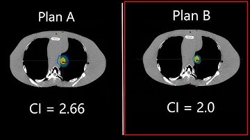 ClearCheck Conformity Index