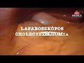 Laparoszkópos cholecystectomia  - apróköves epehólyag 🔰💥🔰