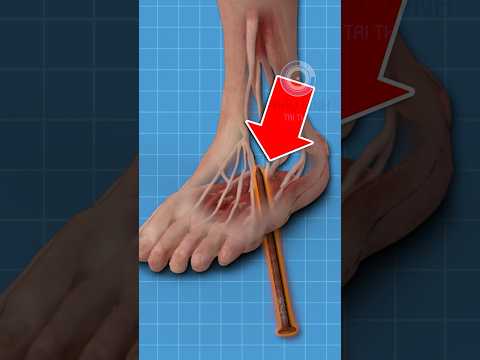Video NẾU BẠN NHIỄM VI KHUẨN UỐN VÁN … | 😨 (Bạn Biết Không) #facts #amazingfact #thaukinhtrithuc - youtube