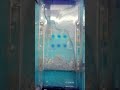 Gel electrophoresis #moleculerbiology @MysteryofMicrobes