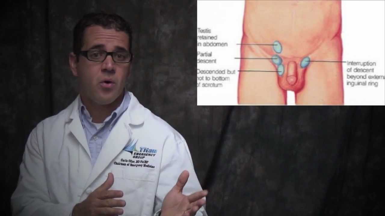 When testicles descend in boys At what age 21 When testicles descend in boys At what age 39