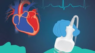 Echocardiography; dp/dt Echocardiography; dp/dt