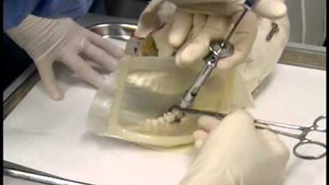 Endodontics Torabinejad 8-4 Periodontal Ligament Injection