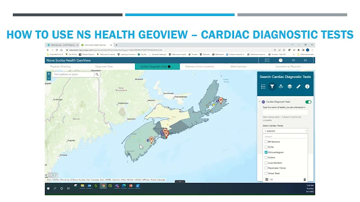 Cardiac Diagnostic Tests How To