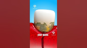 Why Your Gums Bleed When You Brush 🪥😳 #gumbleeding #shorts - Creativelearning3d